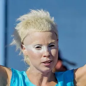 Yolandi Visser